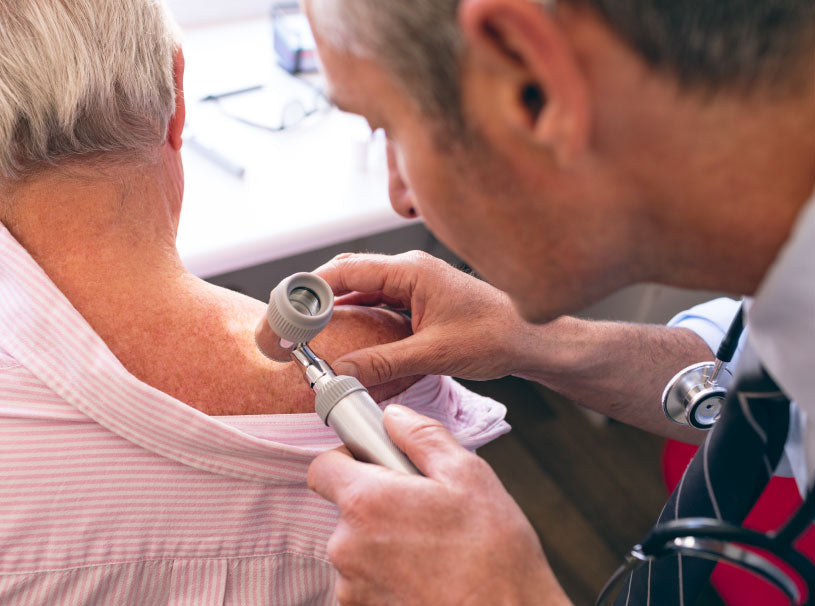 Hablemos sobre el cáncer de piel