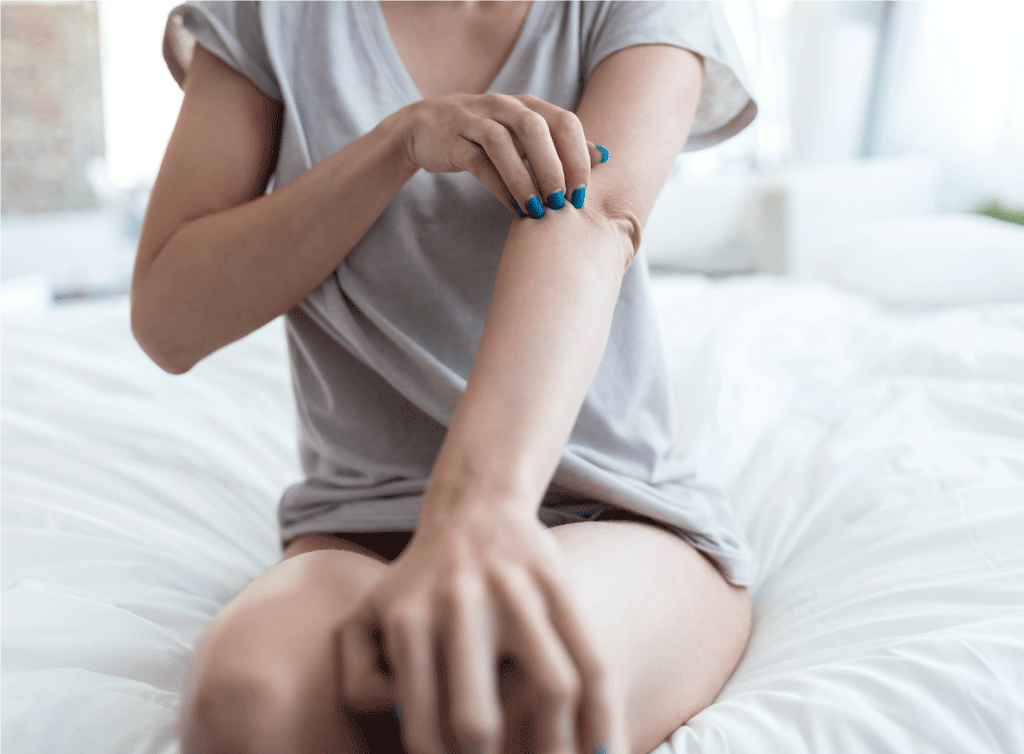 Dermatitis atópica ¿Qué es y cómo cuidarla?