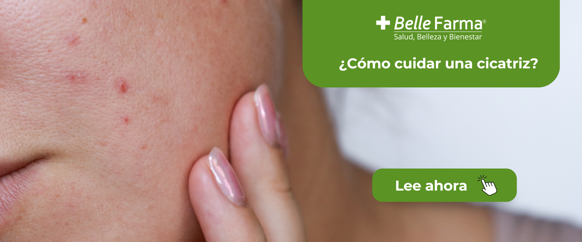 Cicatrices bajo control: cómo regenerar y restaurar tu piel de forma segura